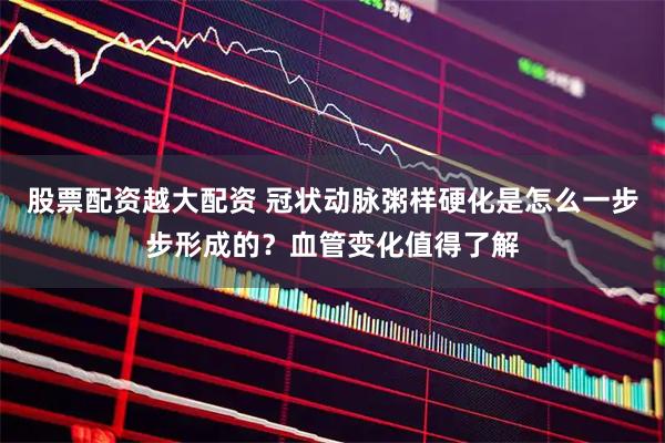 股票配资越大配资 冠状动脉粥样硬化是怎么一步步形成的？血管变化值得了解